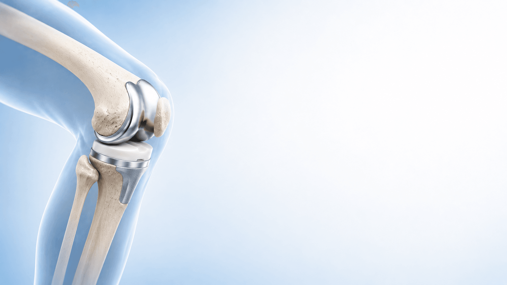 Joint replacement surgery in Bangalore – knee implant for TKR and THR at Pathway Hospital
