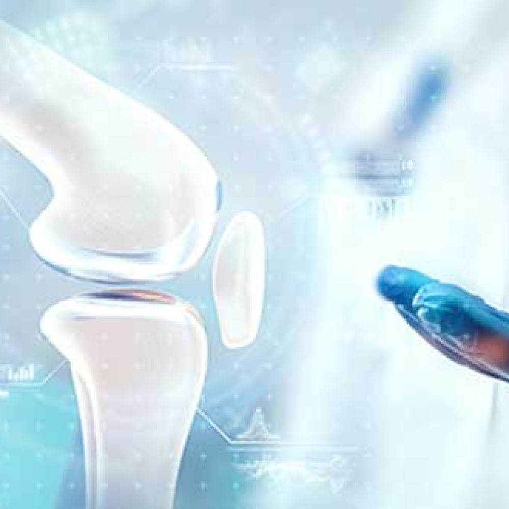 Orthopedics & Join Replacement